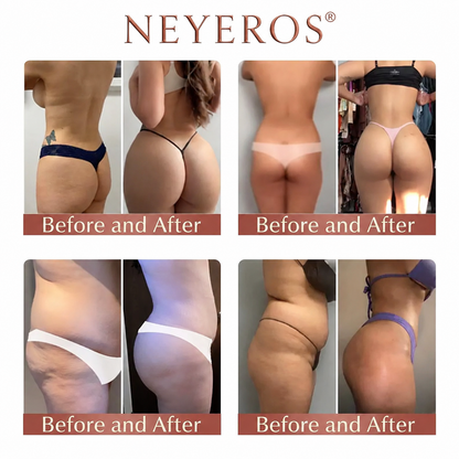 Neyeros® CurveSculpt Micro-Patch ✦ Sculpt • Firm • Smooth Lower Body Curves ✦ Micro-Needle Infusion System